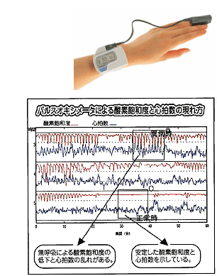 パルスオキシメータによる酸素飽和度と心拍数の現れ方