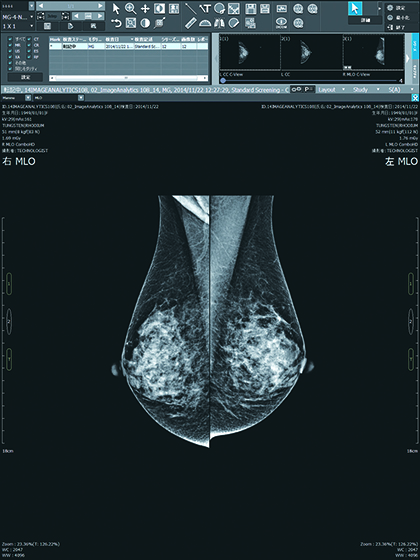 Mammography Viewer