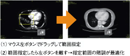 ROI階調処理を搭載