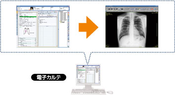 電子カルテ端末相乗り連携