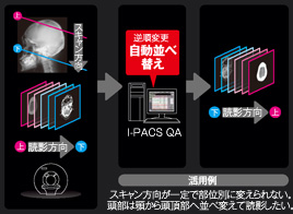 オーダー自動照合機能