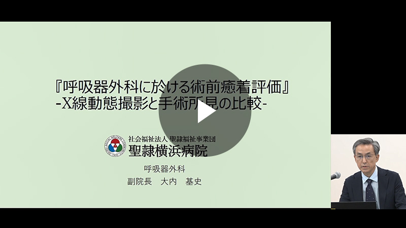 呼吸器外科における術前癒着評価：動態XPと手術所見の比較／大内 基史先生（社会福祉法人聖隷福祉事業団 聖隷横浜病院 呼吸器外科 副院長）