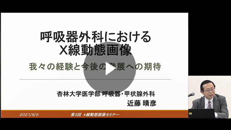 呼吸器外科におけるＸ線動態画像：我々の経験と今後の発展への期待／近藤 晴彦先生（杏林大学医学部 呼吸器・甲状腺外科学教室 教授）