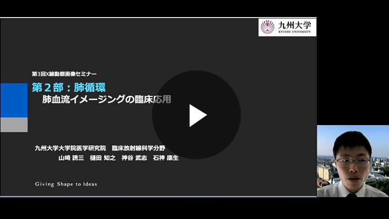 肺血流イメージングの臨床応用／山崎 誘三先生（九州大学大学院医学研究院 臨床放射線科学分野）