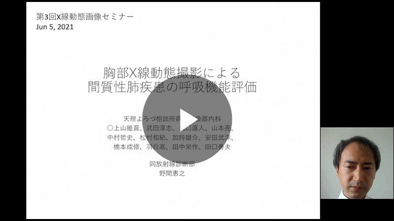 胸部X線動態撮影による間質性肺疾患の呼吸機能評価／上山 維晋先生（公益財団法人天理よろづ相談所病院 呼吸器内科）