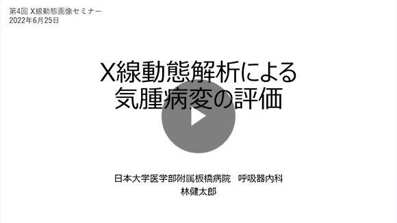 X線動態解析による気腫病変の評価/林 健太郎先生(日本大学医学部内科学系 呼吸器内科学分野)