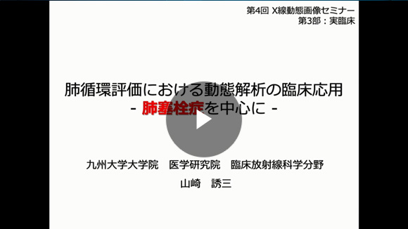 肺循環評価における動態解析の臨床応用 -肺塞栓症を中心に-/山崎 誘三先生(九州大学大学院医学研究院 臨床放射線科学分野)
