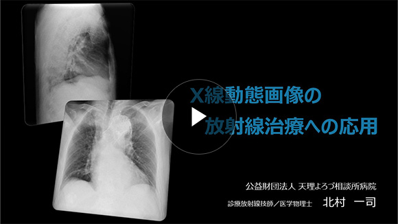 X線動態画像の放射線治療への応用/北村 一司先生(公益財団法人天理よろづ相談所病院 放射線部)