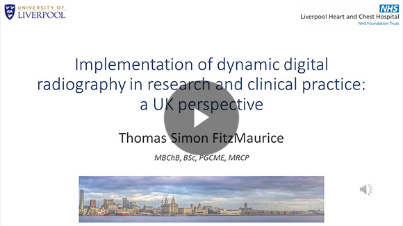 Implementation of dynamic digital radiography in research and clinical practice: a UK perspective／Thomas Simon FitzMaurice, MBChB, PhD（Specialty Registrar in Respiratory Medicine, Liverpool Heart and Chest Hospital）