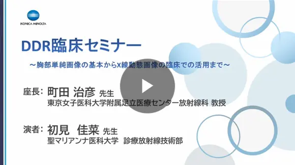 回診車での胸部X線動態撮影における散乱線分布と防護策