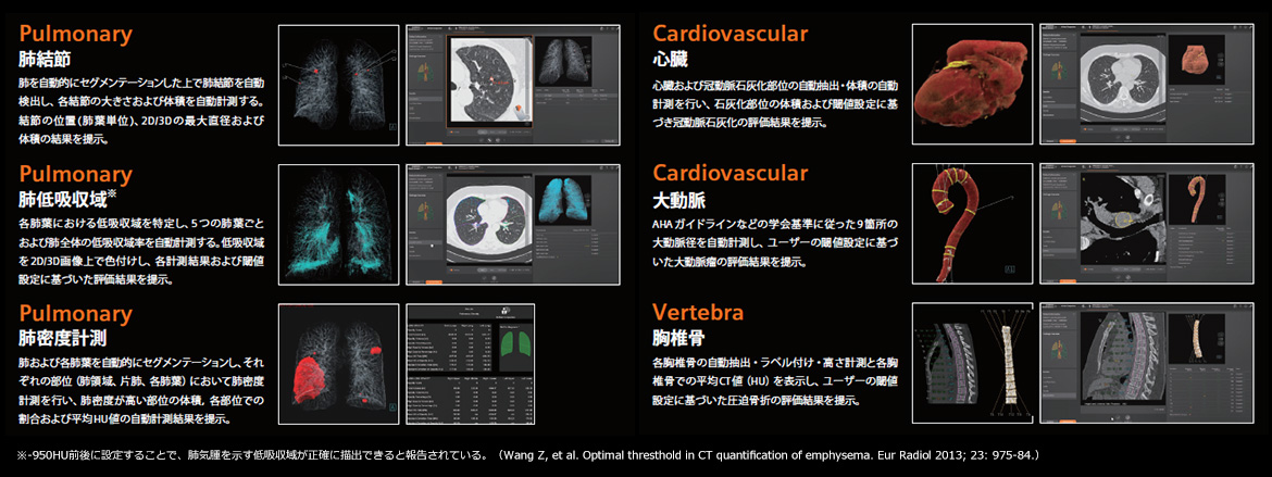 「胸部CT画像AI解析サービス」のCT-AI図（提供：シーメンスヘルスケア株式会社）