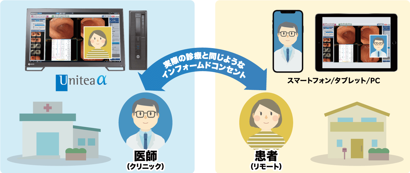 画像診断ワークステーションUnitea α、NEOVISTA I-PACS EX5が取り扱う画像を患者と共有し、インフォームドコンセントが可能