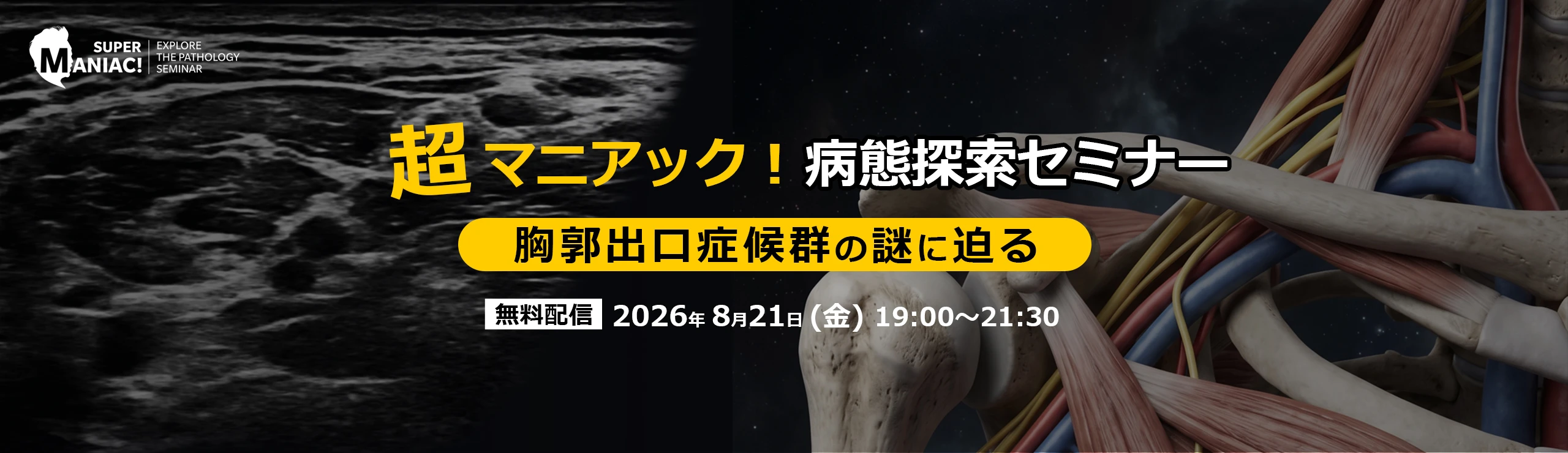 超マニアック！病態探索セミナー ー胸郭出口症候群の謎に迫るー