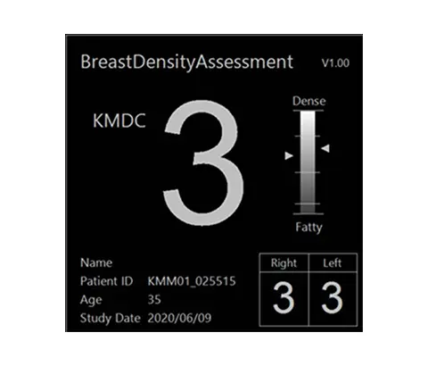 Breast density assessment