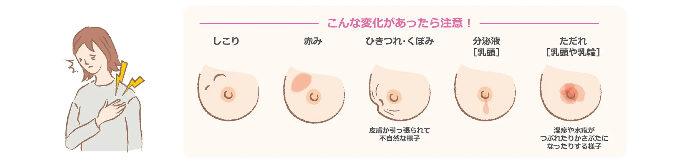 乳房チェック