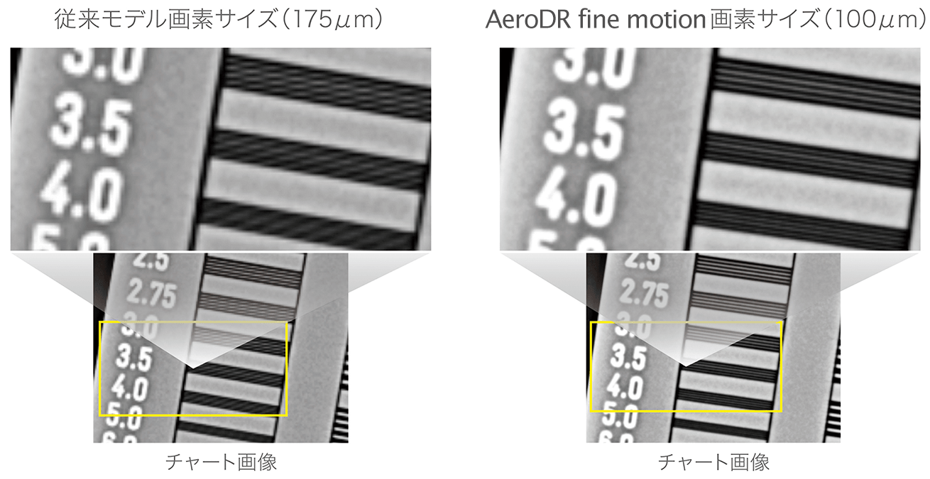従来モデル画素サイズ（175μm）と AeroDR fine motion/fine 画素サイズ（100μm) 
