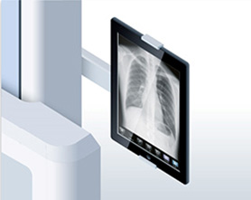 タブレット端末に画像と患者情報を表示するイメージ
