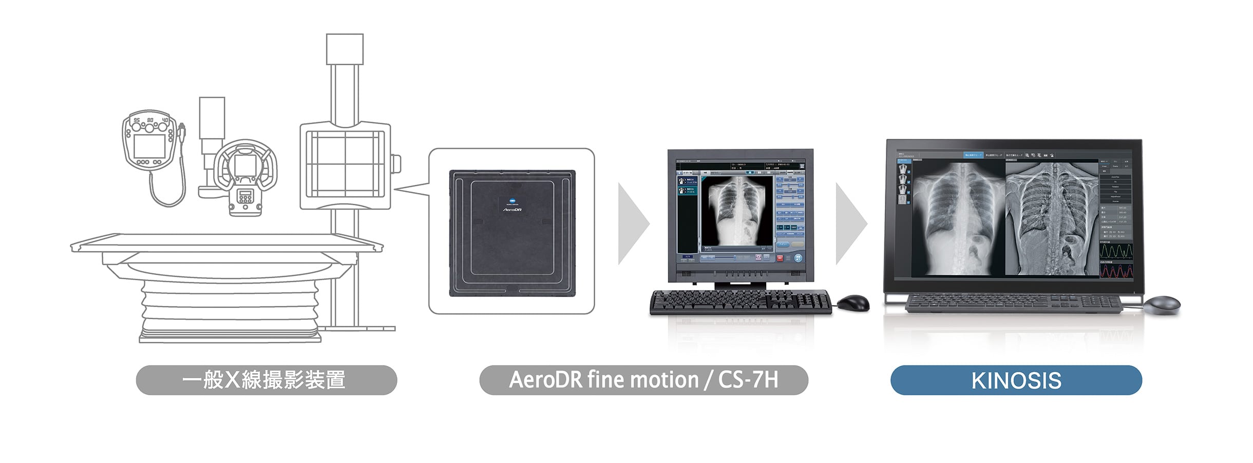 一般X線撮影装置 → AeroDR fine motion / CS-7 → KINOSIS