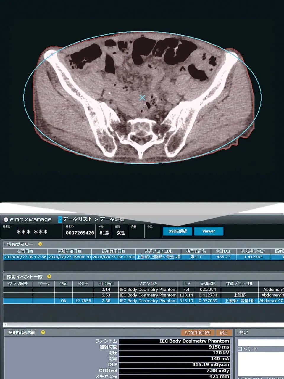 SSDE自動計測機能