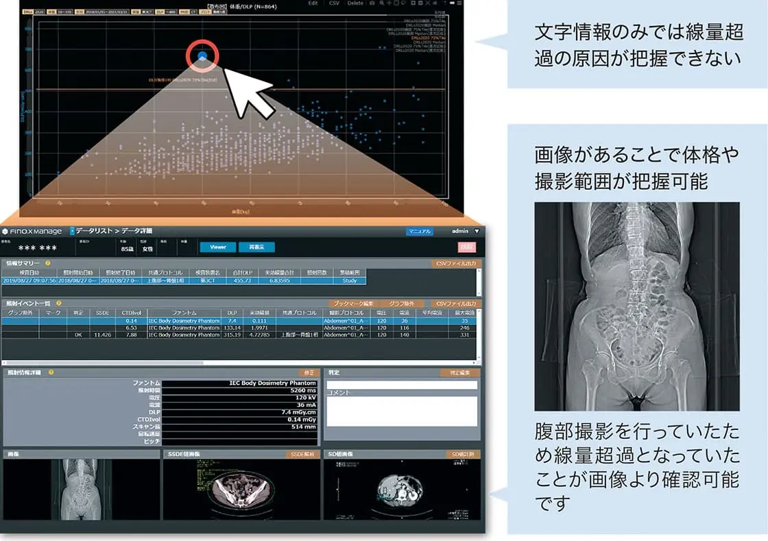 画像情報があることで線量超過データの原因究明もよりスムーズにおこなえる
