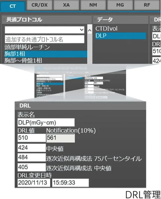 ガイドラインのDRLとの比較に加えて、施設独自のDRL設定を登録する事が可能