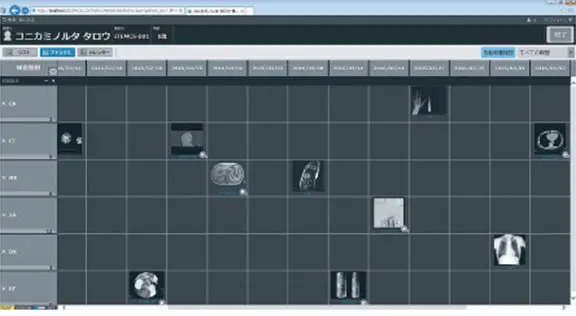 マトリクス表示
