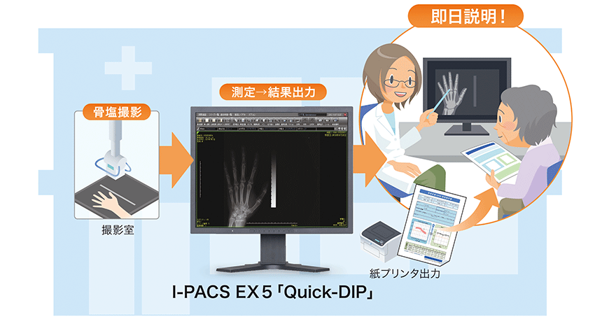 I-PACS EX5「Quick-DIP」説明図