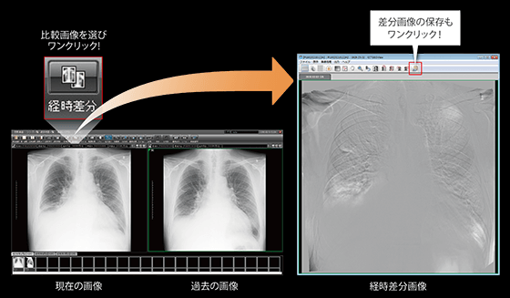 差分画像の保存もワンクリック！