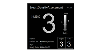 乳房構成解析ソフトウェア Breast Density Assessment (Bda)