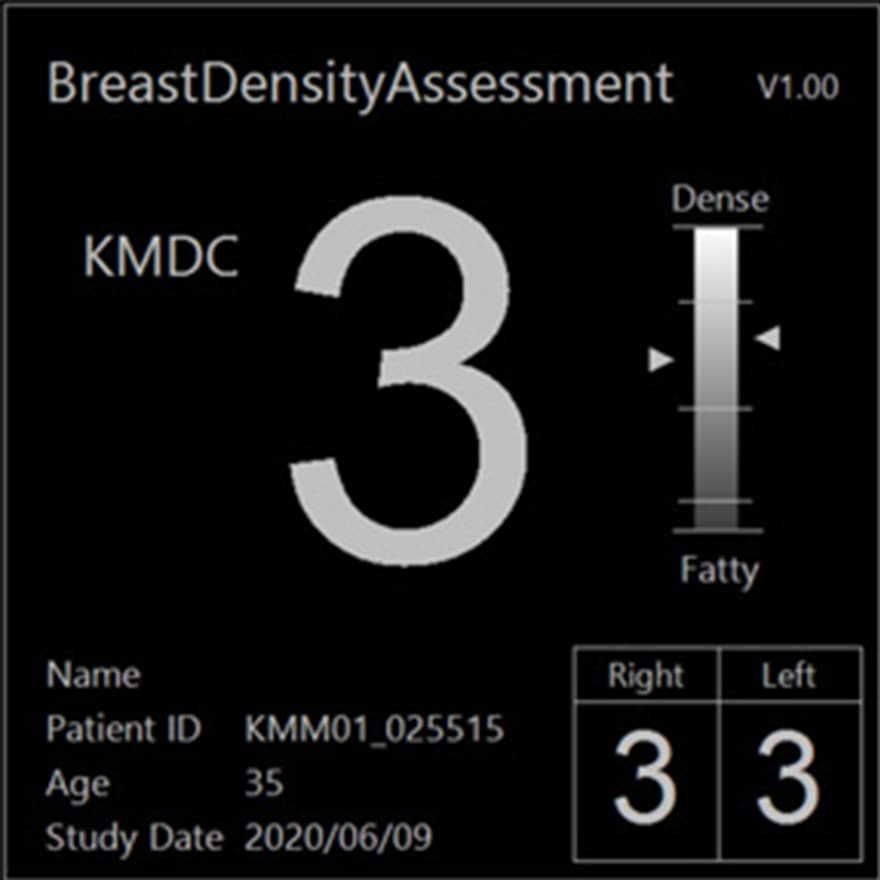 乳房構成解析ソフトウェア Breast Density Assessment（Bda）