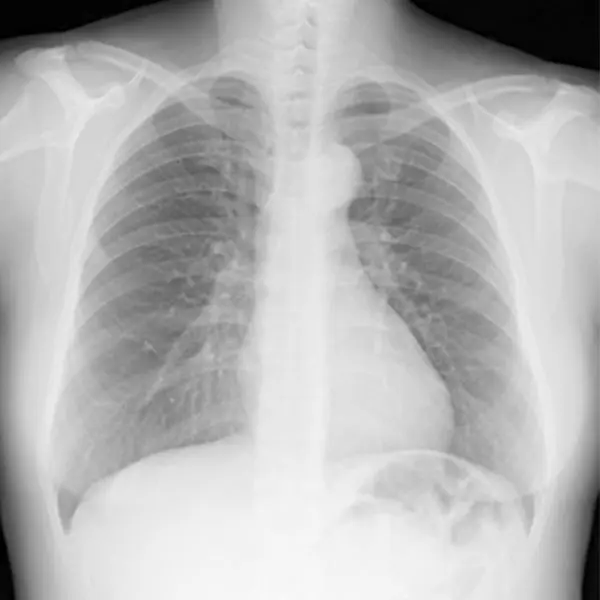 オリジナル画像