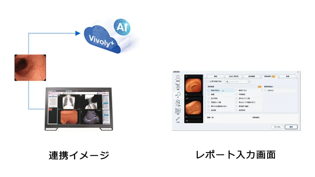 高度なレポート作成