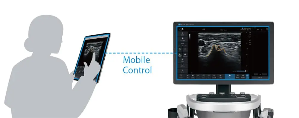 装置を手元で自在に操作 Mobile Control