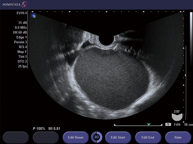 Sonovista Fx Premium Edition コニカミノルタ