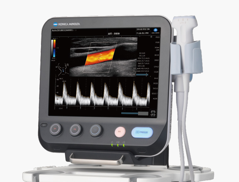超音波診断装置 SONIMAGE MX1