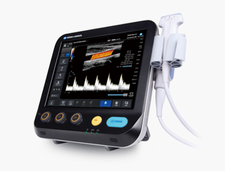 超音波診断装置 SONIMAGE MX1α