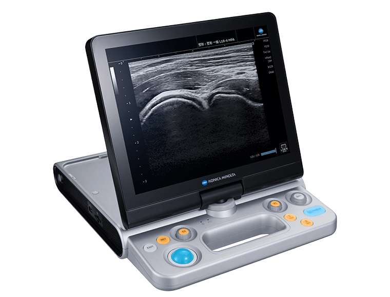 超音波画像診断装置 SNIBLE2