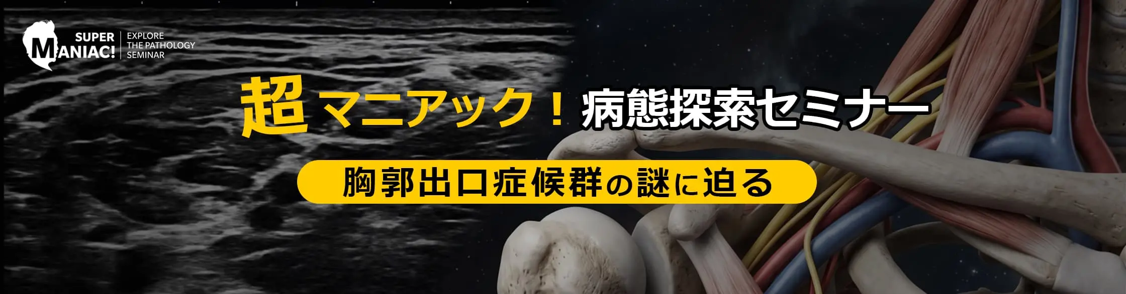 超マニアック！病態探索セミナー</small><br> ー胸郭出口症候群の謎に迫るー
