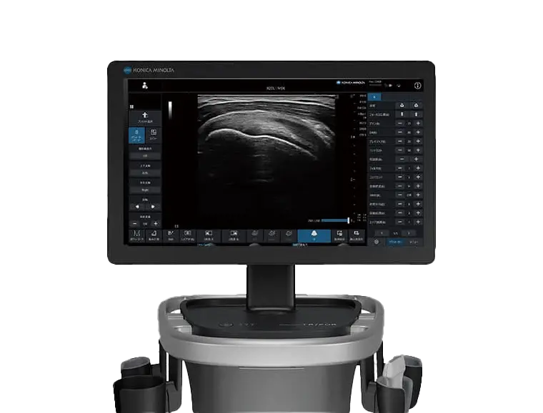 超音波診断装置 SONIMAGE UX1 TRiFOR