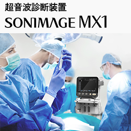超音波画像診断装置 SONIMAGE MX1