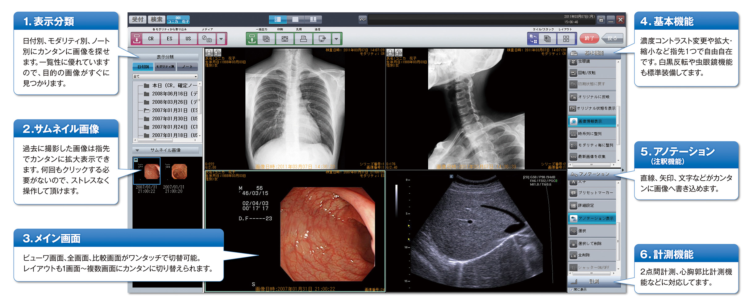 Unitea αの操作画面
