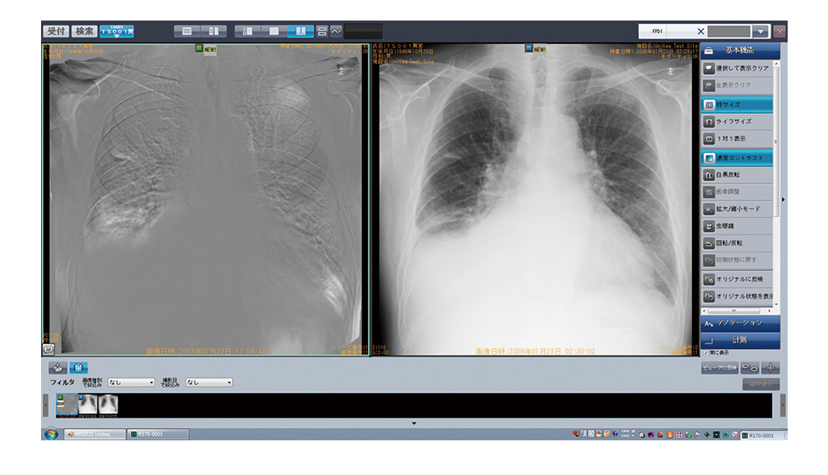 Temporal Subtraction処理