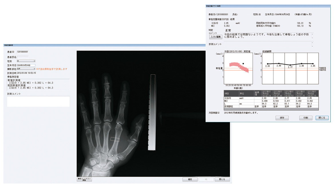 骨密度測定サービス「Quick-DIP」