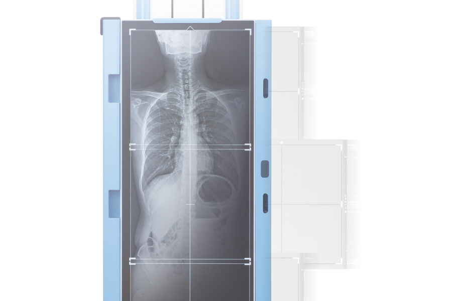 AeroDR One Shot Stitching 長尺撮影