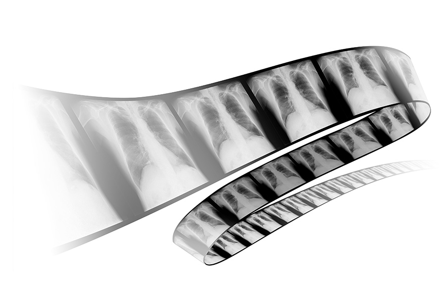 Dynamic Digital Radiography デジタル動画撮影