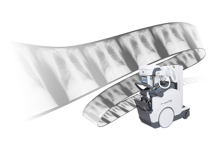 Dynamic Digital Radiography デジタル動画撮影(回診)