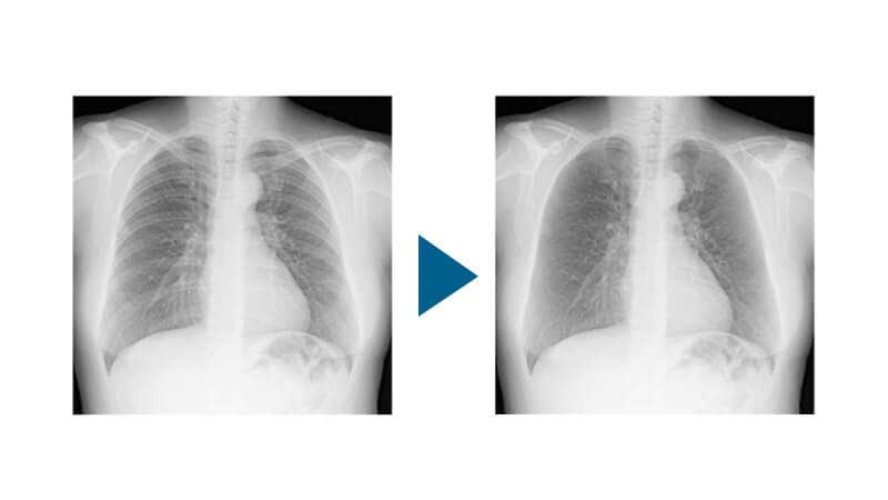 画像処理 / 診断支援サービス